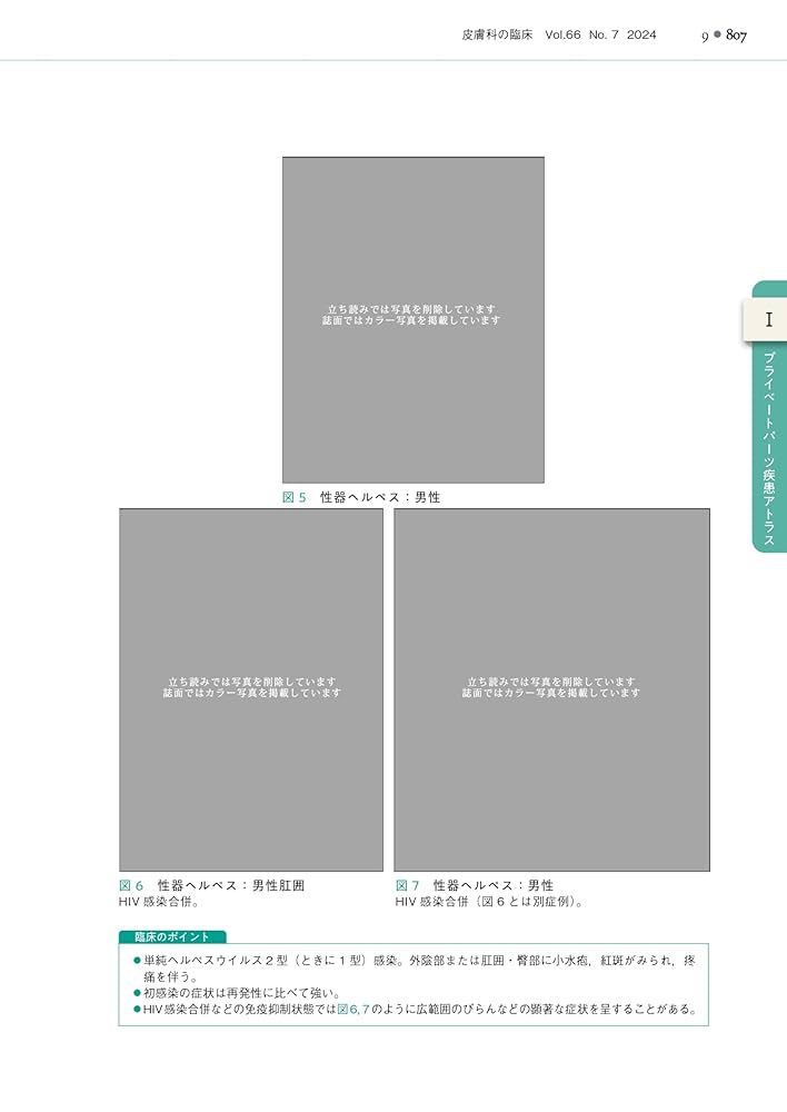 アトラスでみる外陰部疾患 プライベートパーツの診かた アトラスでみる外陰部疾患 プライベートパーツの診かた